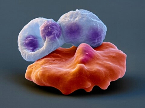 tick fever tick fever in blood cell