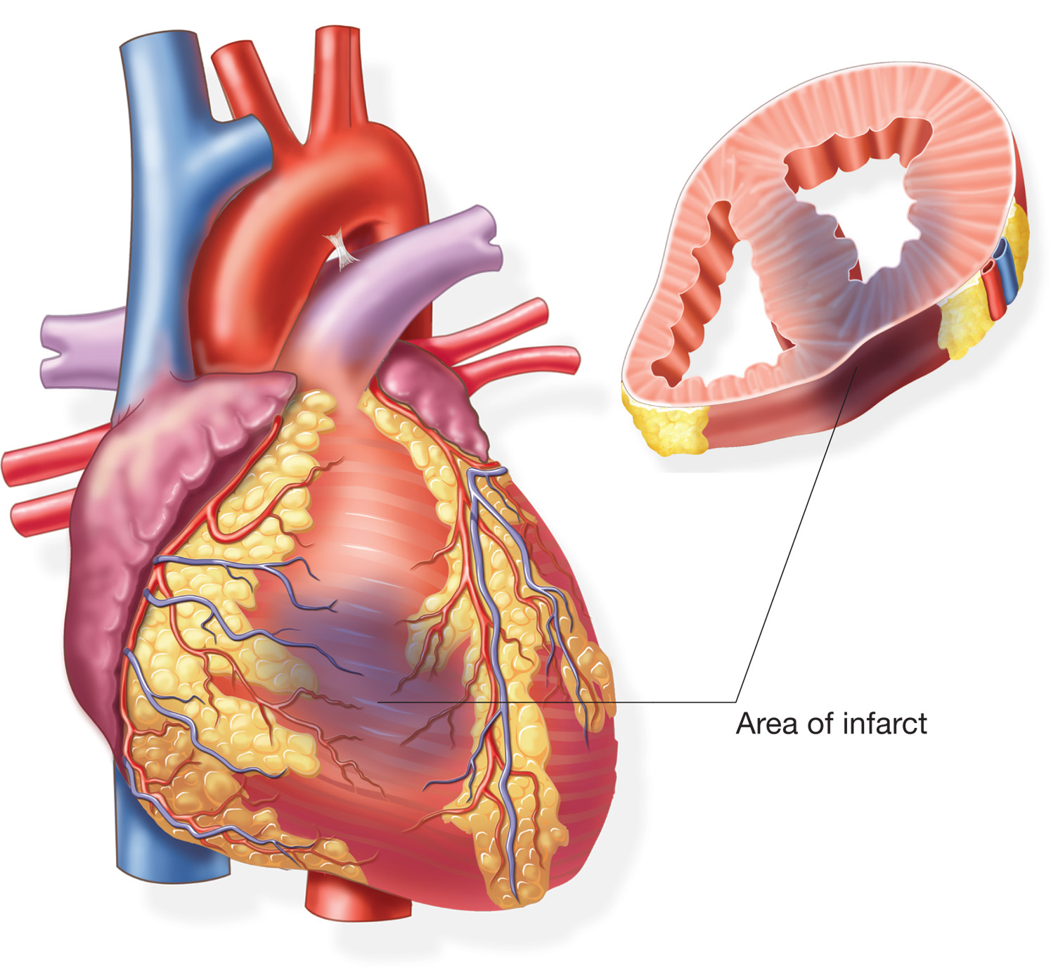 dog heart attack heart anatomy