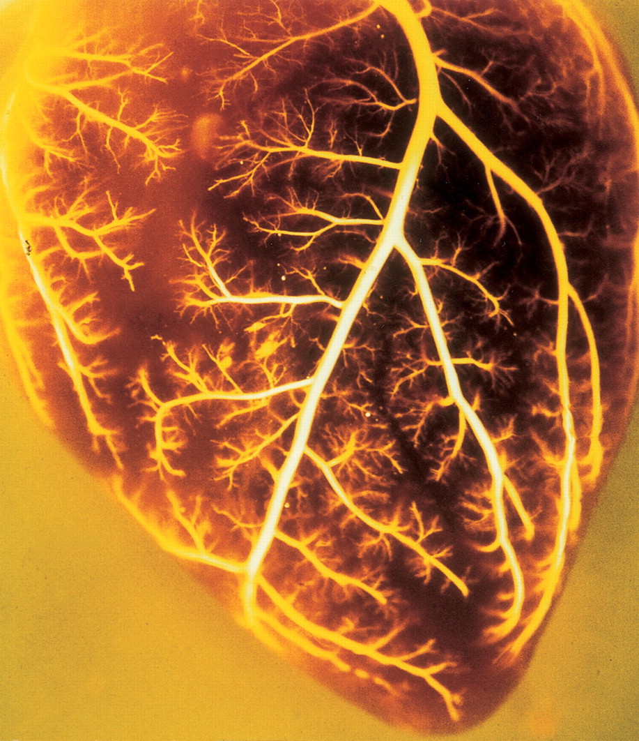 dog heart attack illustration